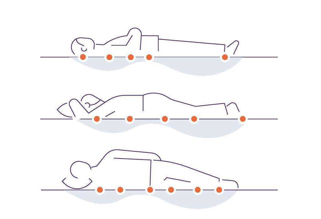 места возникновения пролежней