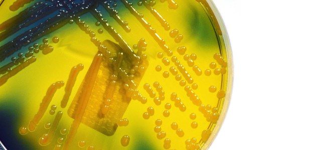 Клебсиелла пневмония в кале Клебсиелла пневмония в кале