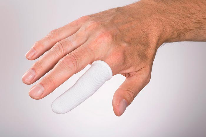 ожог мизинца