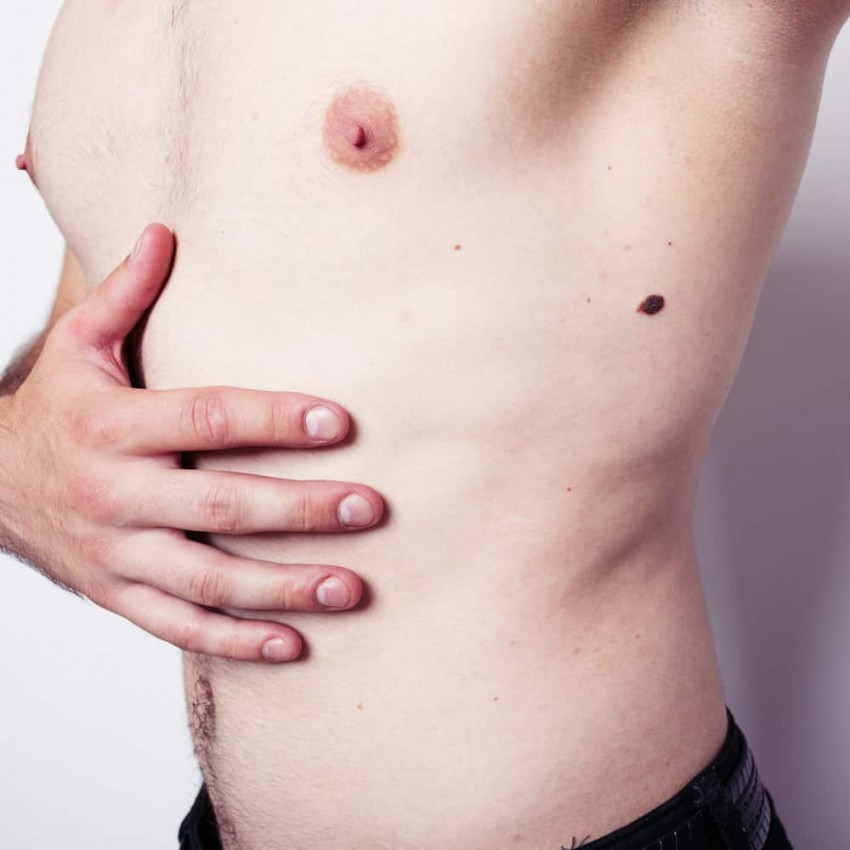 Большая родинка: что делать и к какому врачу обращаться. Современные методы удаления родинок (105 фото и видео)