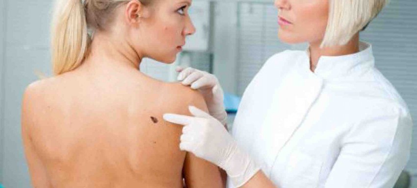 Бородавки на теле: описание видов, причины возникновения, лечение и профилактика. 115 фото бородавок