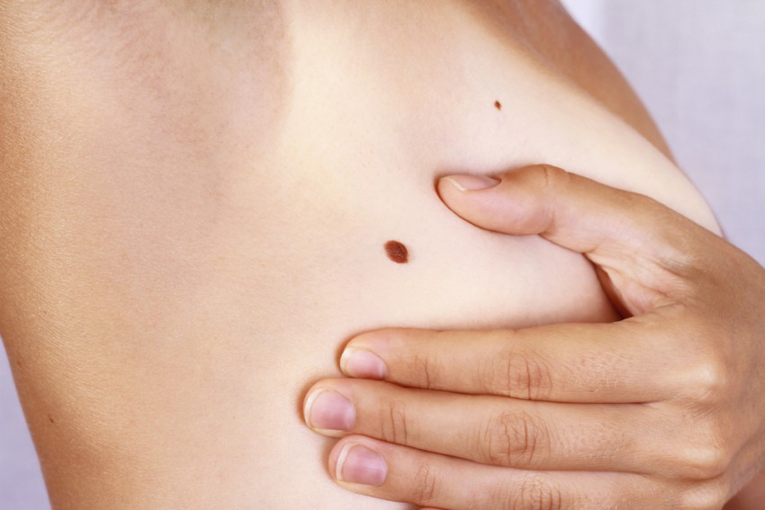 Чешется родинка - поиск причины, варианты лечения и советы по уходу за областью вокруг родинки (100 фото)