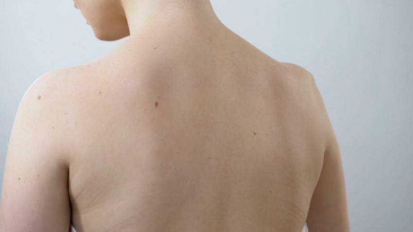 Чешется родинка - поиск причины, варианты лечения и советы по уходу за областью вокруг родинки (100 фото)