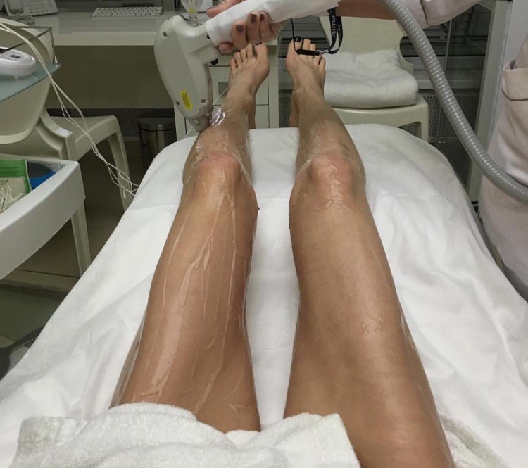 Фотоэпиляция - отзывы, противопоказания, мнения специалистов, эффективность и этапы проведения процедуры (135 фото и видео)