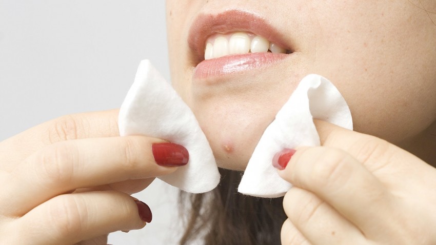 Гнойные прыщи - как быстро и эффективно избавиться в домашних условиях. Советы и рекомендации дерматологов по лечению (115 фото)