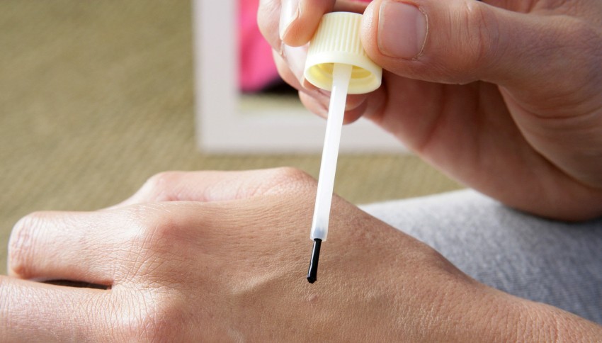 Как убрать бородавку: самые эффективные народные и медицинские средства по удалению бородавок своими руками (125 фото и видео)