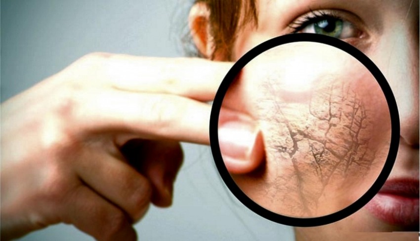 Лечение псориаза: комплексные методы лечения и восстановления кожи. Советы экспертов по выбору средств и плана лечения (125 фото)