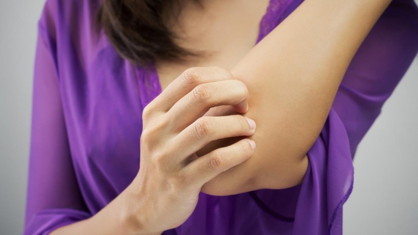 Лишай на руке - 115 фото как выглядит лишай и видео рекомендации дерматологов по лечению болезни