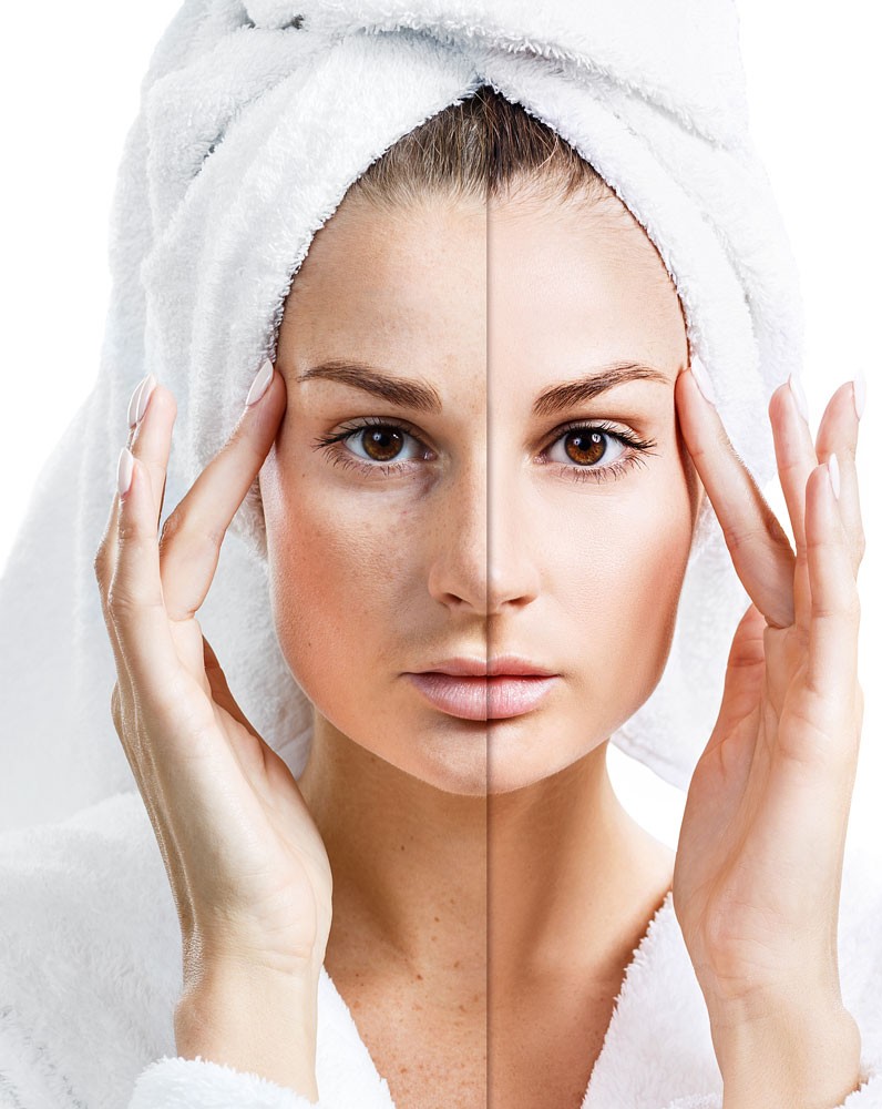 Маски от прыщей - состав, применение, противопоказания, советы косметологов по нанесению и рецепты масок для домашних процедур (130 фото и видео)