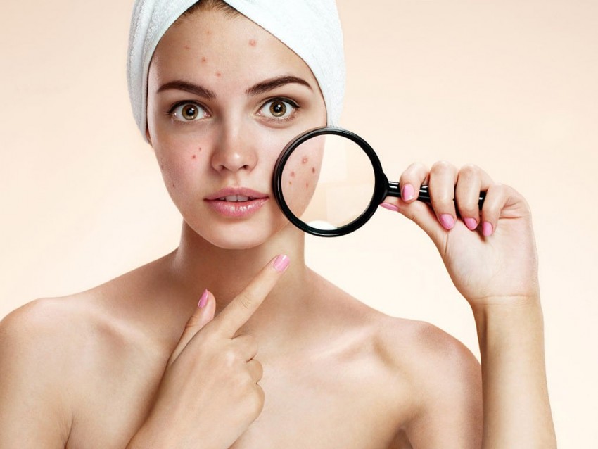 Масло от прыщей - советы по выбору, способы и эффективность применения. Отзывы потребителей и экспертов (125 фото и видео)