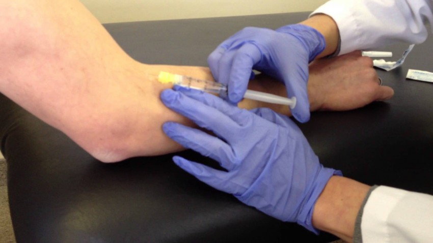 Мезотерапия тела - что это такое, зоны применения и советы косметологов по назначению процедуры (110 фото)