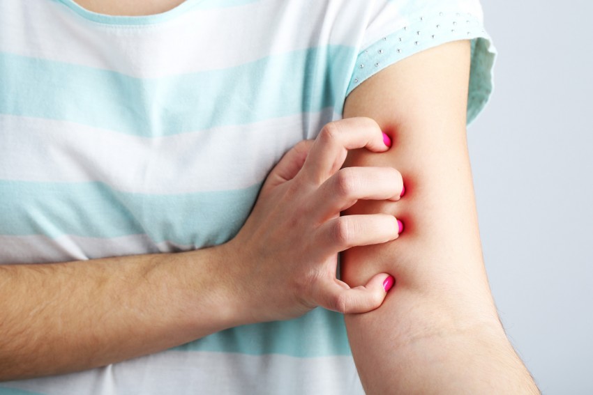 Начальная стадия псориаза: симптомы возникновения заболевания, методы купирования распространения болезни и варианты лечения (130 фото)