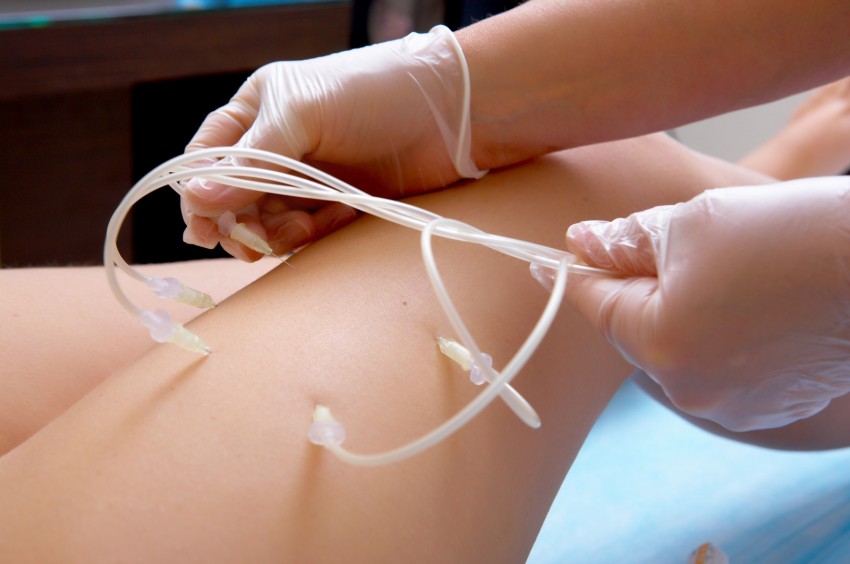 Озонотерапия - что это за процедура и показания к назначению в косметологии (115 фото + видео)