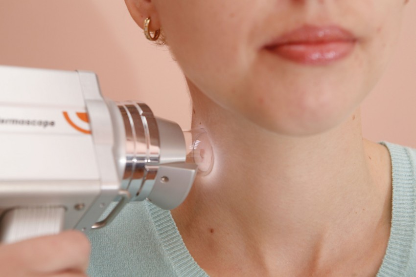 Причины появления родинок: как возникают и когда становятся опасными родинки на теле (110 фото и видео)