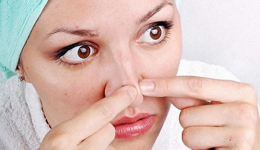 Причины прыщей: обзор основных причин и советы врачей как избавиться от прыщей. Профилактика появления прыщей (110 фото и видео)