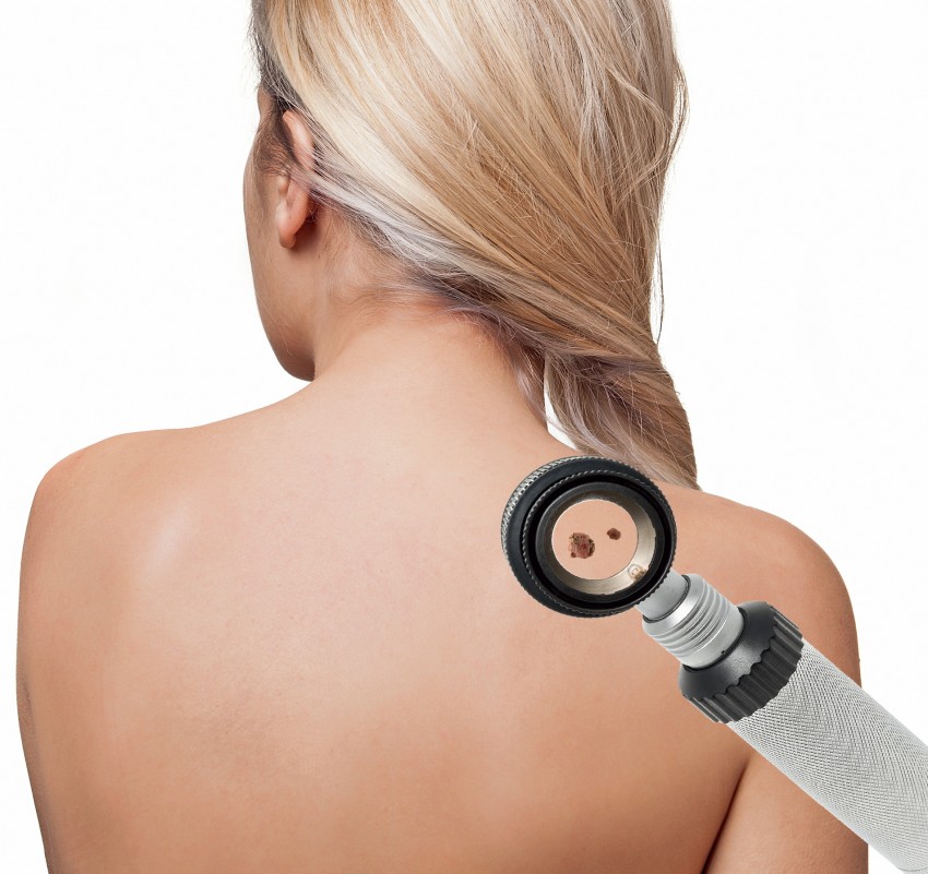 Проверить родинки - пошаговая инструкция как самостоятельно проверить родинки на онкологию. Советы экспертов и обзор типовых ситуаций (120 фото и видео)