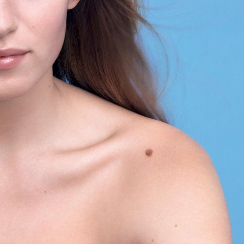 Проверить родинки - пошаговая инструкция как самостоятельно проверить родинки на онкологию. Советы экспертов и обзор типовых ситуаций (120 фото и видео)