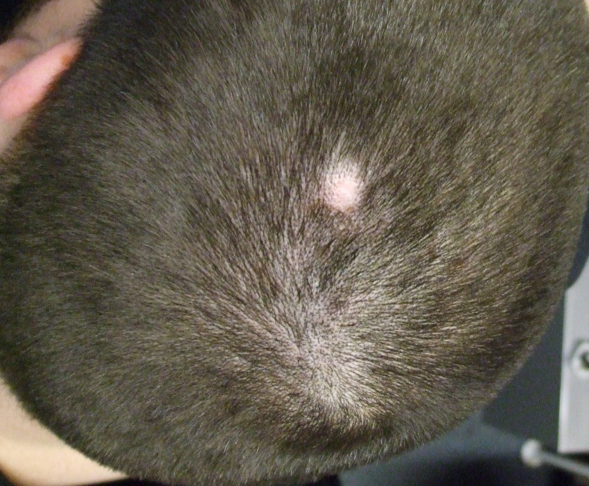 Прыщи на голове - причины появления, болезненные ощущения от прыщей и методы избавления (105 фото)