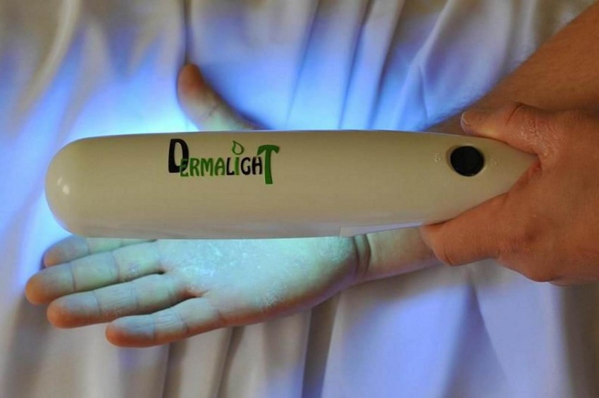 Псориаз в домашних условиях - причины возникновения, диагностика болезни и лечение народными методами (140 фото)