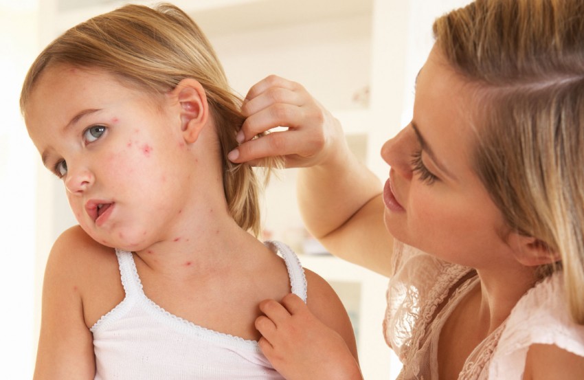 Псориаз у детей - начальные стадии, признаки развития, симптомы и варианты лечения. 110 фото и меры профилактики