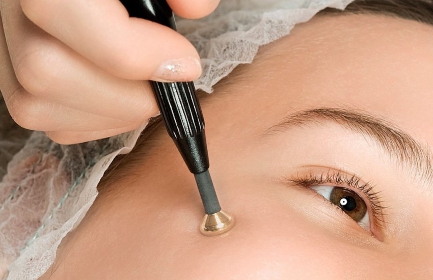 Большая бородавка - причины появления, виды и классификация. К какому врачу обращаться для удаления бородавки?