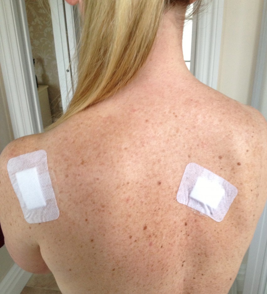 Родинка на спине: как выглядит и где проверить родинку на онкологию. 100 фото и видео рекомендации по оценке родинок