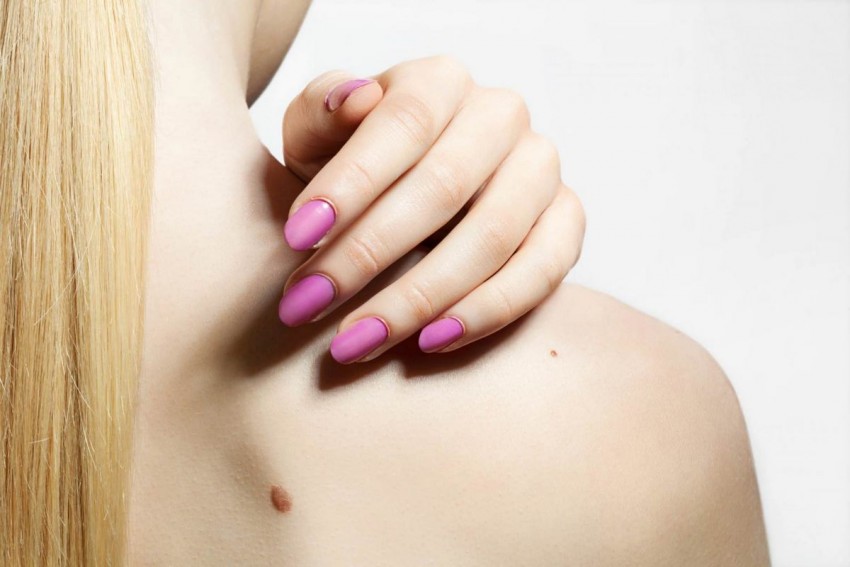 Родинки на теле - описание, строение, как и каким врачом проверяются. Как происходит удаление родинок (видео + 105 фото)