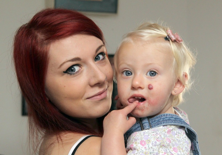 Родинки у детей - где проверяются родинки у новорожденных и дошкольников? Причины появления, 120 фото и видео родинок