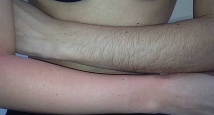 Воск против эпилятора: что лучше выбрать