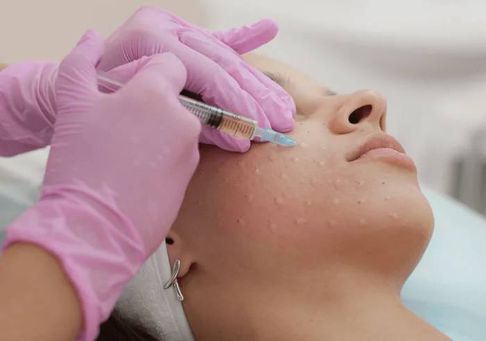Процедуры по разглаживанию морщин: 5 лучших видов салонных процедур