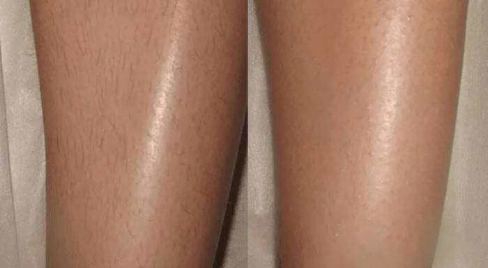 Эффективный шугаринг в домашних условиях: как делать и что для этого необходимо