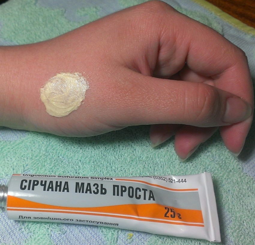 Средство от лишая: эффективность, цена, показания и противопоказания к применению. 125 фото и видео использования современных средств