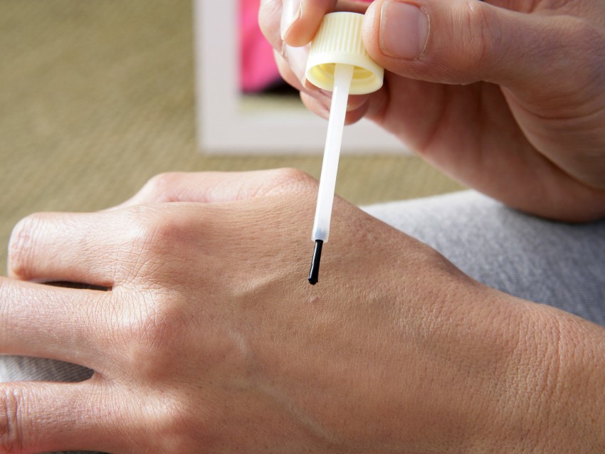 Удаление бородавок - способы, методы, цены, эффективность и противопоказания к удалению (видео + 130 фото)