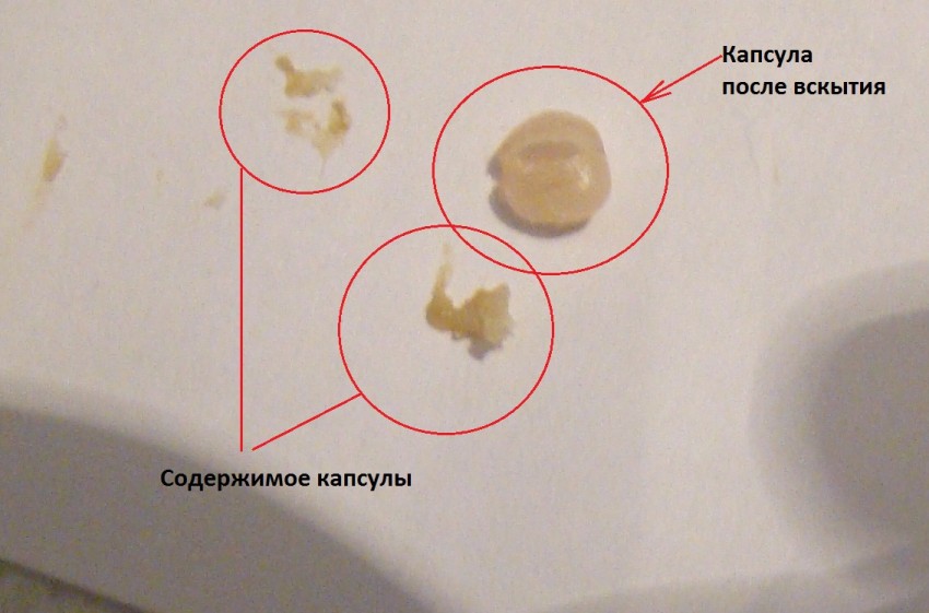 Удаление жировика: поэтапное описание операции, эффективные методы послеоперационного ухода и рекомендации врачей по удалению жировика (140 фото)