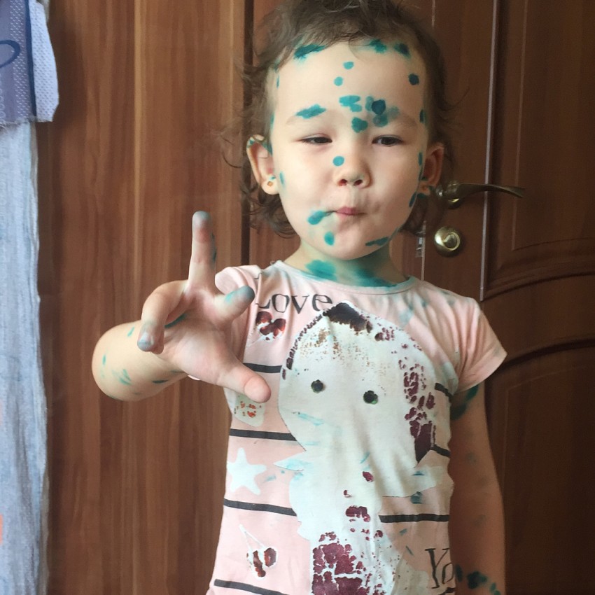 Ветрянка у детей - 150 фото, симптомы, лечение и распространенные методы профилактики. Советы дерматологов как вылечить ветрянку