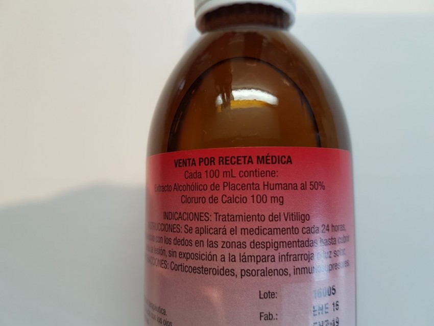 Витилиго - причины появления, симптомы, виды, диагностика и лечение в клинике и в домашних условиях (видео + 135 фото)