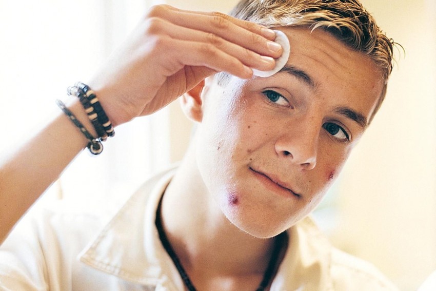 Выдавливание прыщей: советы врачей-дерматологов и косметологов можно ли выдавливать и как это делать правильно (140 фото и видео инструкция)