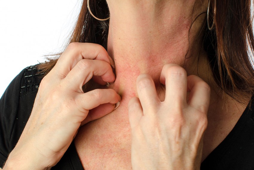 Аллергия на коже: виды, проявления, симптомы и варианты лечения. 140 фото и видео советы по выявлению аллергена
