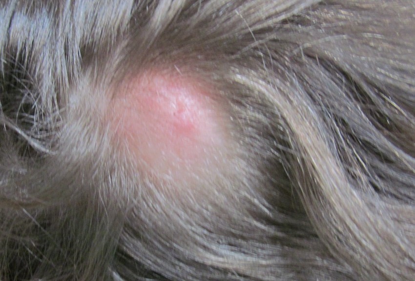 Белая родинка: причины, симптомы, опасность и диагностика серьезных заболеваний. 125 фото злокачественных и доброкачественных родинок