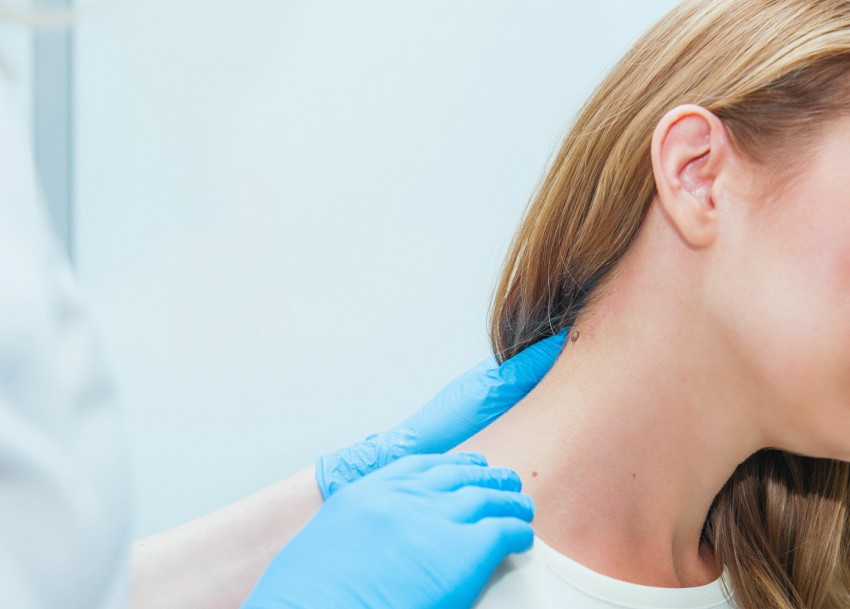 Белая родинка: причины, симптомы, опасность и диагностика серьезных заболеваний. 125 фото злокачественных и доброкачественных родинок