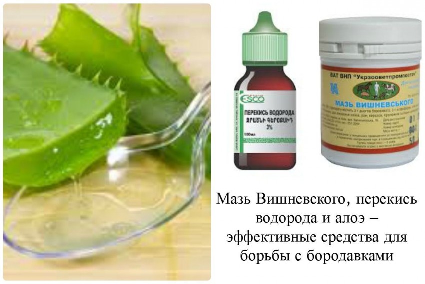 Вывести бородавки в домашних условиях - удаление бородавки своими руками. Пошаговая инструкция и отзывы о самых эффективных методах (130 фото + видео)