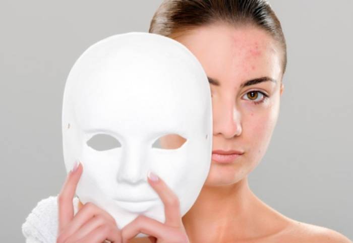 Как избавиться от прыщей - лучшие средства, советы дерматологов и рекомендации по уходу за кожей (85 фото)