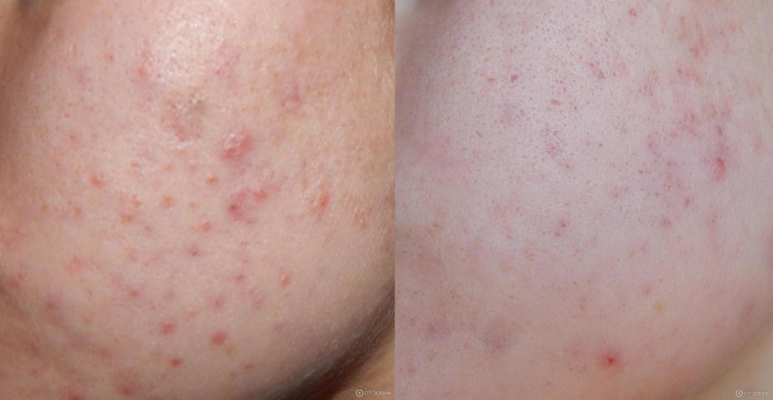 Куриозин - пошаговая инструкция по применению, особенности использования и правила нанесения (90 фото)