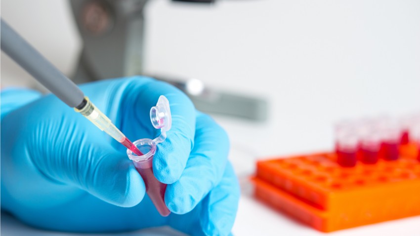 Лечение акне - способы и препараты для лечения кожи. Советы и рекомендации дерматологов по выбору лечения (70 фото)