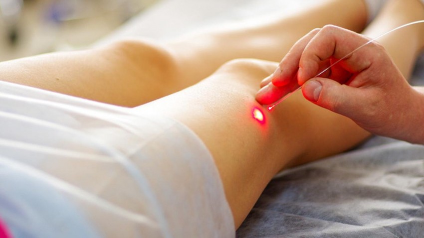 Лечение бородавок - симптомы, причины и диагностика заболевания. Советы по выбору специалиста и методики лечения (95 фото)