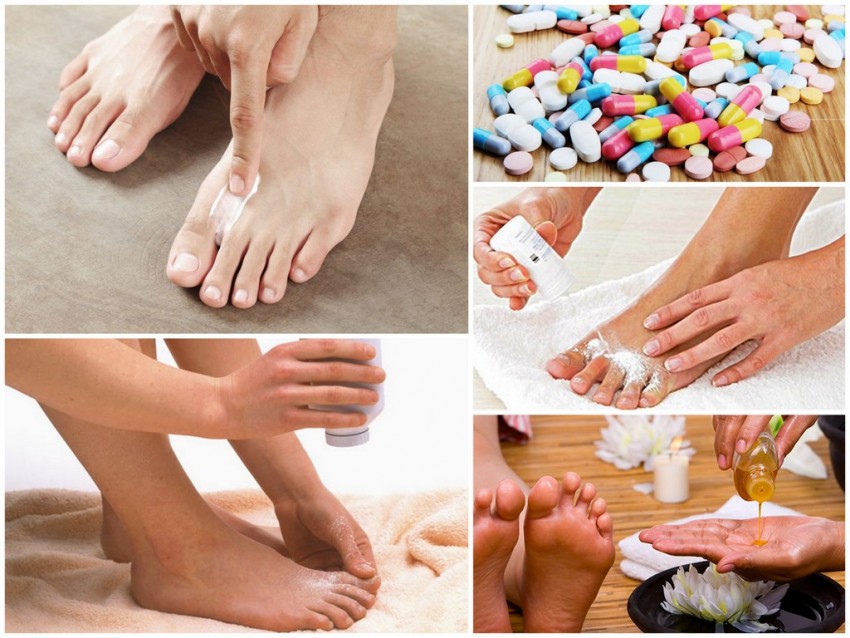 Лечение грибка - советы опытных врачей по подбору эффективных средств избавления от грибка (90 фото)