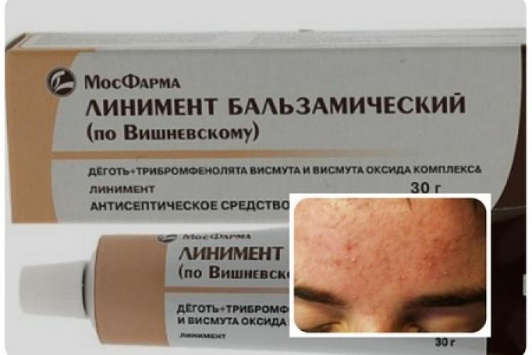 Мазь Вишневского - инструкция и описание применения. Состав, противопоказания и для чего применяется мазь (115 фото и видео)