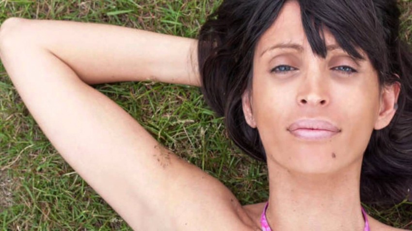 Много родинок - к какому врачу обращаться, опасные формы и определение типов родинок (90 фото)