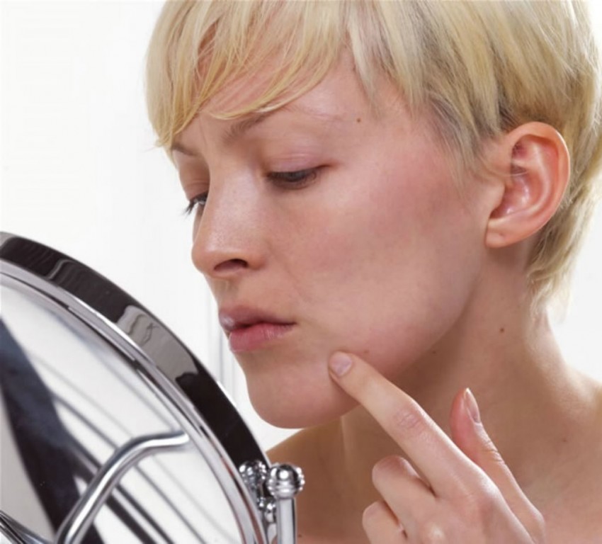 Плоские бородавки - диагностика причин появления, симптомы, проявления и особенности лечения (110 фото и видео)