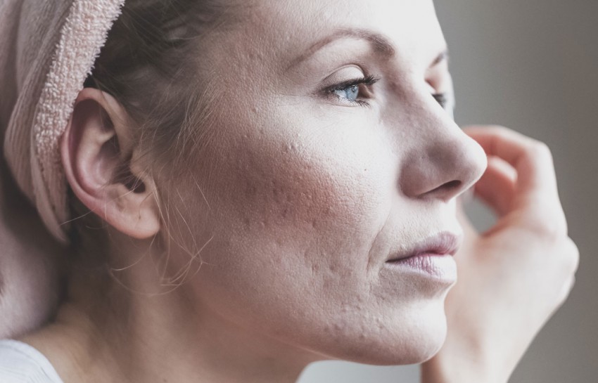 Прыщ в ухе: причины появления и лечение фурункулов. Профилактика заболевания и методы удаления у взрослых и детей (75 фото)